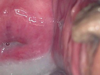 cervix